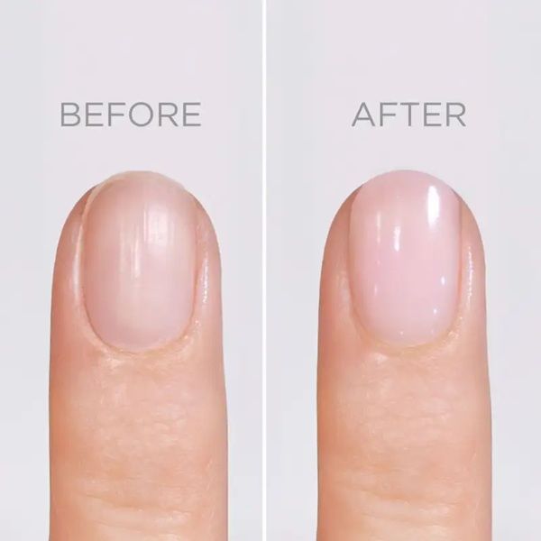 Artdeco Lac de Unghii Nail Care Sos Nail Rapair 10ml